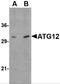 Autophagy Related 12 antibody, 4421, ProSci, Western Blot image 