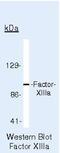 Coagulation factor XIII A chain antibody, PA5-16423, Invitrogen Antibodies, Western Blot image 