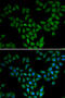 Anti-Silencing Function 1A Histone Chaperone antibody, abx005007, Abbexa, Western Blot image 