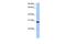 RALY RNA Binding Protein Like antibody, GTX47193, GeneTex, Western Blot image 