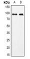 Ubiquitin Specific Peptidase 13 antibody, LS-C668078, Lifespan Biosciences, Western Blot image 