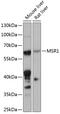 Macrophage Scavenger Receptor 1 antibody, 15-416, ProSci, Western Blot image 