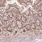 TBC1 Domain Family Member 17 antibody, PA5-64361, Invitrogen Antibodies, Immunohistochemistry paraffin image 