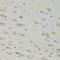 Ribosomal Protein L9 antibody, LS-C748670, Lifespan Biosciences, Immunohistochemistry paraffin image 
