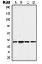 Angio Associated Migratory Cell Protein antibody, orb213509, Biorbyt, Western Blot image 