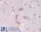 Doublecortin Like Kinase 1 antibody, LS-B15568, Lifespan Biosciences, Immunohistochemistry paraffin image 