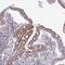 VPS42 antibody, HPA057649, Atlas Antibodies, Immunohistochemistry paraffin image 