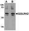Golgi Membrane Protein 1 antibody, NBP1-77079, Novus Biologicals, Western Blot image 