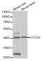 General Transcription Factor IIA Subunit 1 antibody, abx004087, Abbexa, Western Blot image 