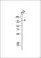 TSC Complex Subunit 2 antibody, PA5-35235, Invitrogen Antibodies, Western Blot image 