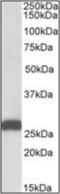 Electron Transfer Flavoprotein Subunit Beta antibody, orb375340, Biorbyt, Western Blot image 