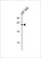 Ciliary Neurotrophic Factor antibody, 60-996, ProSci, Western Blot image 