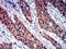 Semaphorin 4D antibody, NBP2-61663, Novus Biologicals, Immunohistochemistry paraffin image 