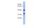 L37mt antibody, GTX45001, GeneTex, Western Blot image 