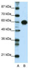 Zinc Finger And SCAN Domain Containing 5A antibody, TA341389, Origene, Western Blot image 