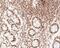 Metastasis Associated 1 Family Member 2 antibody, NBP2-80409, Novus Biologicals, Immunohistochemistry paraffin image 