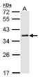 Survival Of Motor Neuron 2, Centromeric antibody, PA5-27309, Invitrogen Antibodies, Western Blot image 