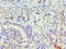 Transient Receptor Potential Cation Channel Subfamily M Member 8 antibody, LS-C676652, Lifespan Biosciences, Immunohistochemistry paraffin image 