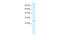 Polycomb Group Ring Finger 3 antibody, 28-083, ProSci, Enzyme Linked Immunosorbent Assay image 