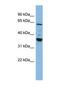 Cytochrome P450 Family 3 Subfamily A Member 7 antibody, NBP1-69670, Novus Biologicals, Western Blot image 