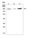 Fibrinogen Alpha Chain antibody, A00816-3, Boster Biological Technology, Western Blot image 