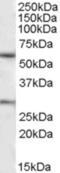 Potassium Voltage-Gated Channel Subfamily Q Member 1 antibody, NBP1-30119, Novus Biologicals, Western Blot image 