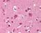 FYN Proto-Oncogene, Src Family Tyrosine Kinase antibody, 49-115, ProSci, Immunohistochemistry frozen image 