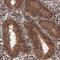 ST13 Hsp70 Interacting Protein antibody, NBP2-61615, Novus Biologicals, Immunohistochemistry frozen image 