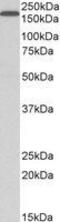 Low-density lipoprotein receptor-related protein 5 antibody, GTX89521, GeneTex, Western Blot image 