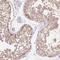 Thyroid Hormone Receptor Interactor 13 antibody, NBP2-38690, Novus Biologicals, Immunohistochemistry frozen image 