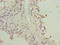 HORMA Domain Containing 2 antibody, LS-C399779, Lifespan Biosciences, Immunohistochemistry paraffin image 