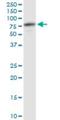 ATPase H+ Transporting V1 Subunit A antibody, H00000523-M02, Novus Biologicals, Western Blot image 