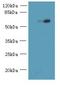 Ubiquitin Specific Peptidase 30 antibody, A61694-100, Epigentek, Western Blot image 