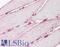 Lamin A/C antibody, LS-B7729, Lifespan Biosciences, Immunohistochemistry paraffin image 
