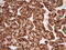 Secreted Frizzled Related Protein 2 antibody, M01752, Boster Biological Technology, Immunohistochemistry paraffin image 