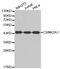 Casein Kinase 2 Alpha 1 antibody, MBS125067, MyBioSource, Western Blot image 