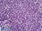 Interferon-inducible protein AIM2 antibody, LS-B5945, Lifespan Biosciences, Immunohistochemistry paraffin image 