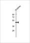 Indian Hedgehog Signaling Molecule antibody, M01448, Boster Biological Technology, Western Blot image 