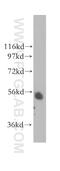 Transcriptional Adaptor 2A antibody, 11299-1-AP, Proteintech Group, Western Blot image 