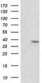 Retinol dehydrogenase 14 antibody, TA502315, Origene, Western Blot image 