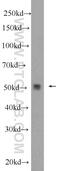 Protein Phosphatase 2 Regulatory Subunit B''Gamma antibody, 24877-1-AP, Proteintech Group, Western Blot image 