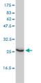 Ubiquitin Conjugating Enzyme E2 T antibody, H00029089-M01, Novus Biologicals, Western Blot image 