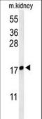 LY6/PLAUR Domain Containing 1 antibody, LS-C163936, Lifespan Biosciences, Western Blot image 