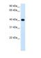 Alcohol Dehydrogenase 4 (Class II), Pi Polypeptide antibody, NBP1-53173, Novus Biologicals, Western Blot image 