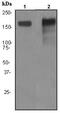 Neurofilament medium polypeptide antibody, ab92539, Abcam, Western Blot image 