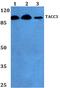 Transforming Acidic Coiled-Coil Containing Protein 3 antibody, PA5-36349, Invitrogen Antibodies, Western Blot image 
