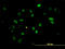 Checkpoint Kinase 2 antibody, LS-B6212, Lifespan Biosciences, Immunofluorescence image 