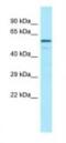 Complement Factor H Related 4 antibody, NBP1-98532, Novus Biologicals, Western Blot image 