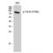 Neurotrophic Receptor Tyrosine Kinase 2 antibody, LS-C380863, Lifespan Biosciences, Western Blot image 