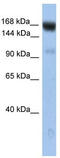 Ubiquitination Factor E4B antibody, TA335000, Origene, Western Blot image 